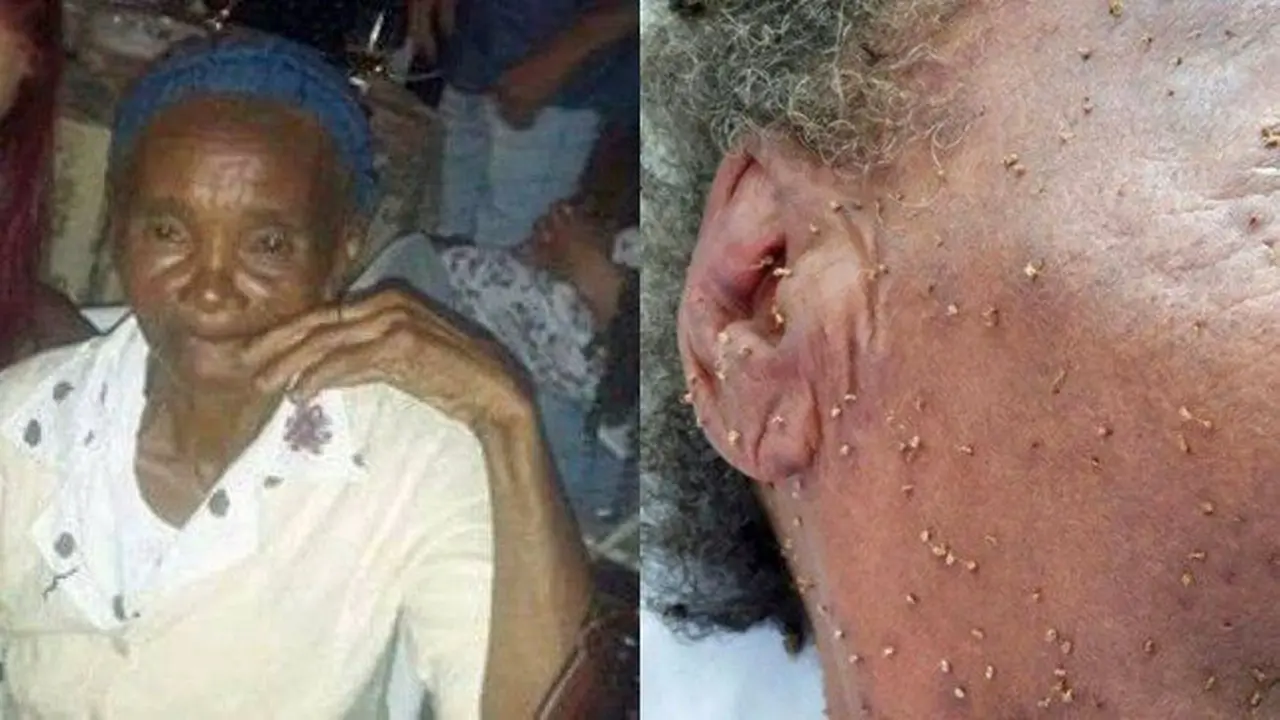 Tragis, Nyawa Nenek 84 Tahun Melayang Setelah Disengat Lebah