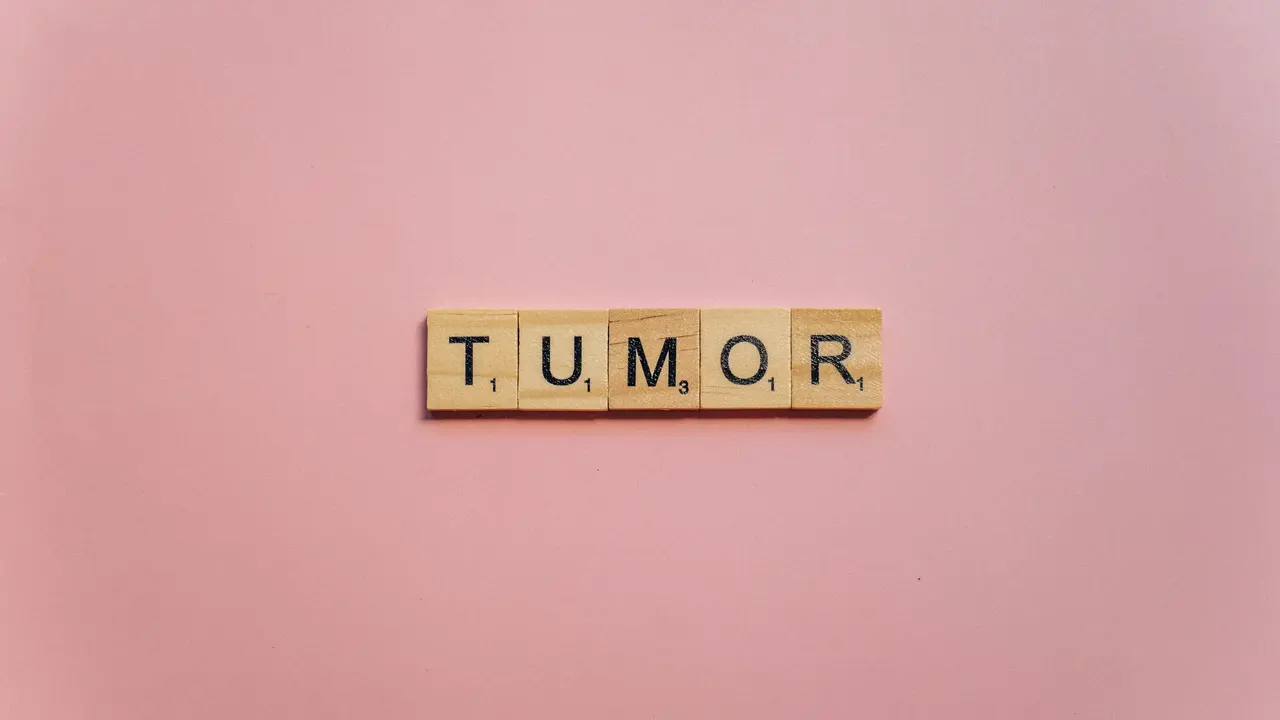 Marshanda Umumkan Idap Tumor Payudara, Kenali Penyebab dan Gejalanya Sejak Dini