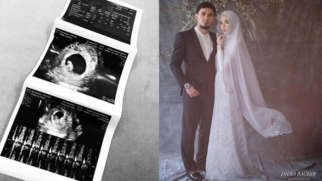 Hamil Anak Pertama Ini 7 Potret Mesra Lindswell Kwok Dan Achmad Hulaefi Hot Liputan6 Com