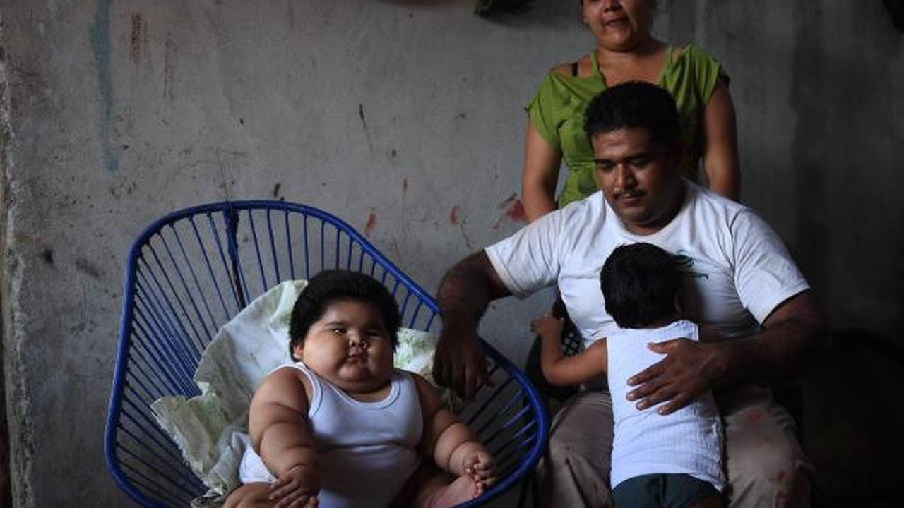 Berat badan Gonzales dirasa tak normal ketika bobot tubuhnya melebihi sang kakak kandung (AFP)