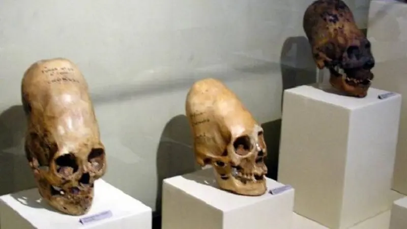 Ilustrasi Kepala Kerucut. (Sumber: Paracas Skulls Ica Museum via Wikimedia Commons/Public Domain)