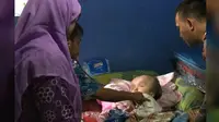 Penderita hydrocephalus di Bogor (Liputan6.com/Achmad Sudarno)