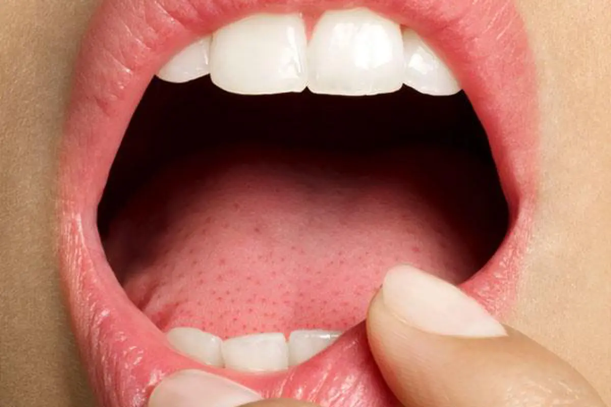 5 Tanda Anda Kurang Mendapat Asupan Vitamin D