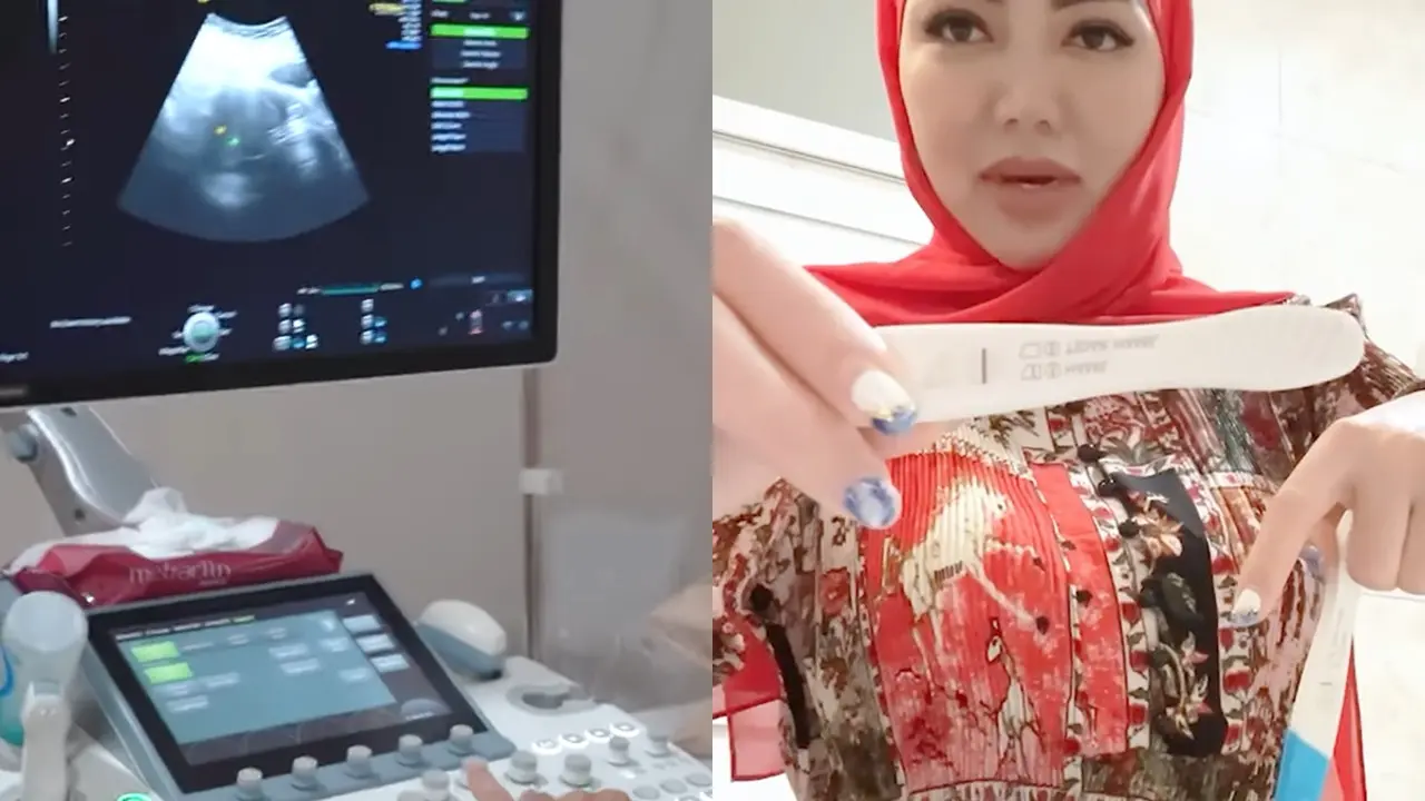 Bella Shofie Hamil Program Bayi Tabung
