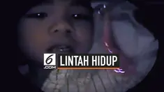 Seorang dokter di Vietnam berhasil mengeluarkan lintah hidup yang bersarang di hiung anak laki-laki berusia 6 tahun. Diduga hewan tersebut masuk ke tubuh bocah tersebut melalui beragam cara.