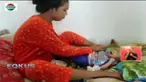 Kondisi Muhammad Adam Syahputra, bayi pendereita gizi buruk akibat diberi susu dewasa mulai membaik.