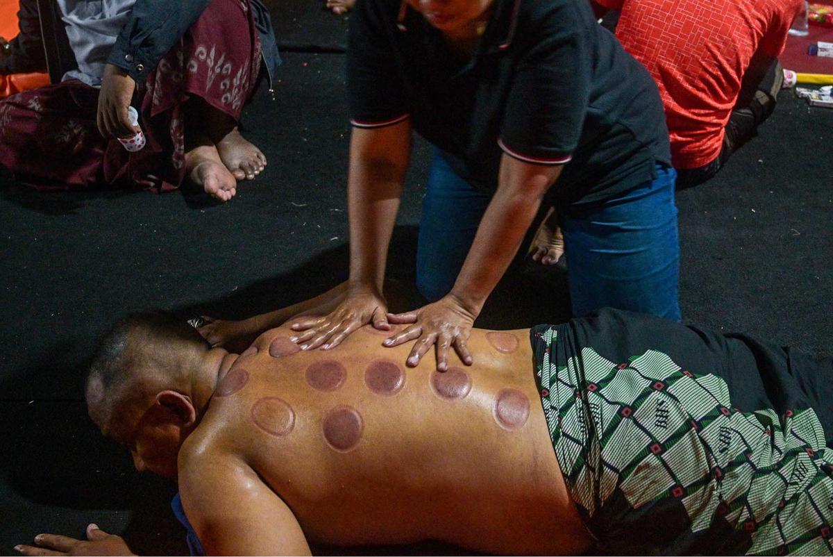 FOTO: Terapi Bekam Tanduk Sapi, Pilihan Lawas di Zaman Modern