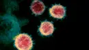 Gambar tak bertanggal menggunakan mikroskop elektron pada Februari 2020 menunjukkan virus corona SARS-CoV-2, diambil dari seorang pasien yang terinfeksi COVID-19. Setelah sebelumnya dikenal sebagai 2019-nCoV, virus ini merupakan penyebab dari apa yang disebut penyakit COVID-19. (NIAID-RML via AP)