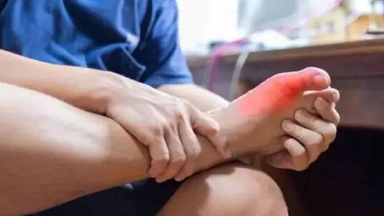 Cara Cepat dan Ampuh Mengatasi Pembengkakan Akibat Asam Urat dengan Air Es Hingga Lemon
