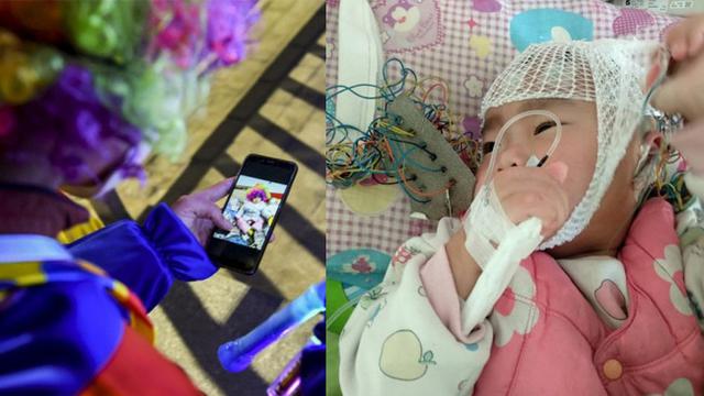 Kisah Pilu Pria Jadi Badut, Banting Tulang Demi Biaya Pengobatan Putrinya