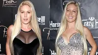 Implan Payudara Melorot, Heidi Montag Ngotot Kecilkan Ukuran