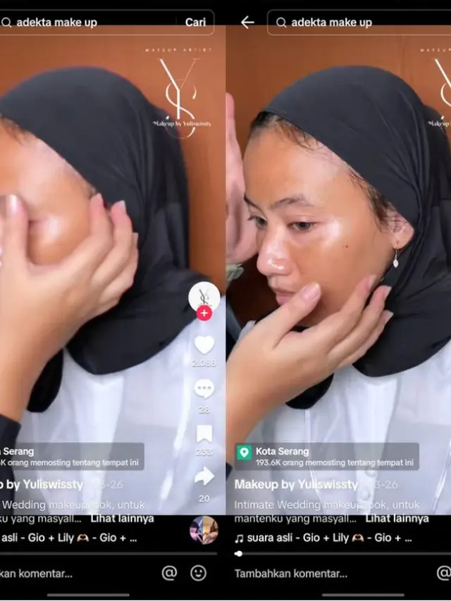 Skin Preparation: Riasan Pengantin untuk Penderita Vitiligo