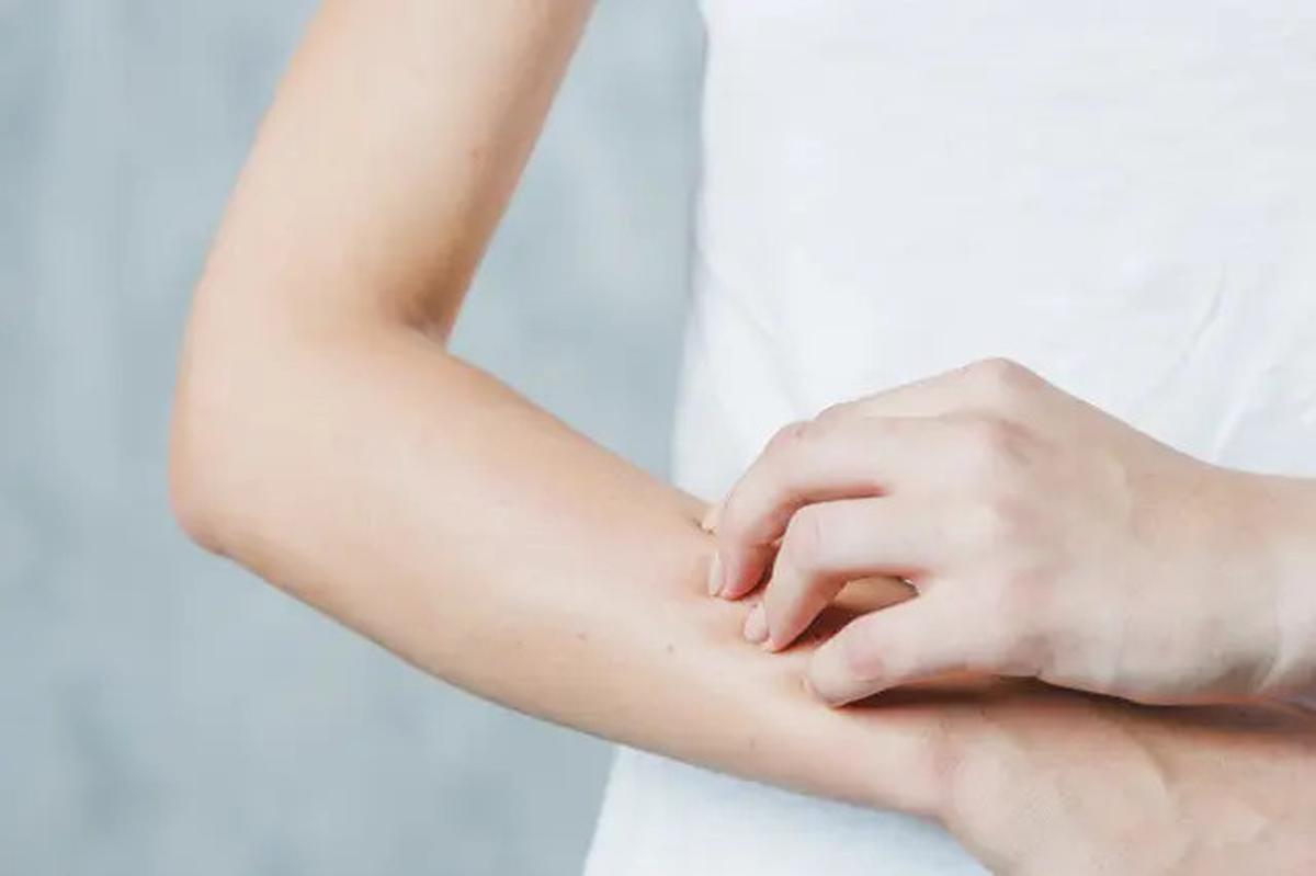 Bagus untuk Diet, Ini 5 Manfaat Minum Air Putih saat Perut Kosong