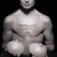 Alih-alih menghindari kanker payudara dan rahim, ibu dua anak asal Kanada ini pilih menghilangkan payudara dan rahimnya.