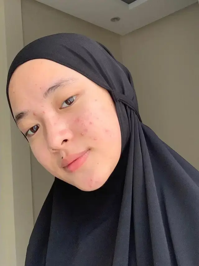 Nissa Sabyan Tanpa Makeup