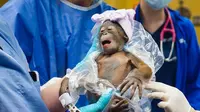 Sayembara Nama Bayi Orang Utan Penghuni Kebun Binatang Amerika Serikat yang Lahir Secara Caesar