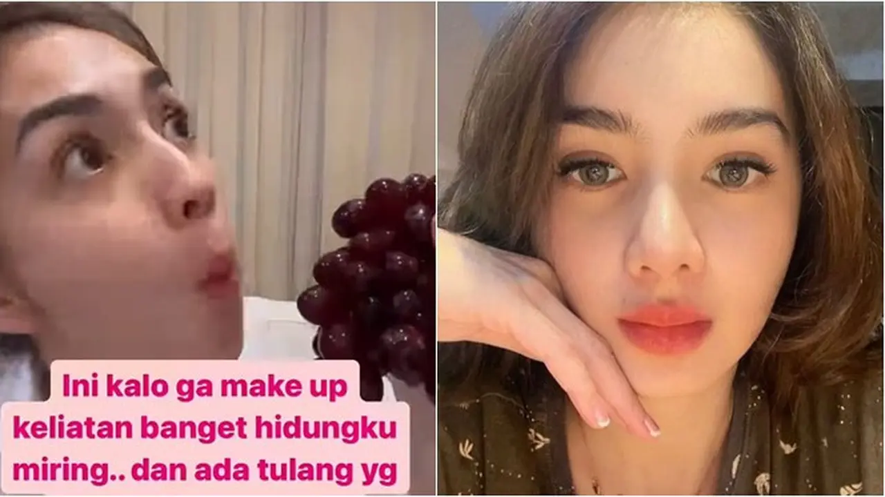 8 Potret Angel Karamoy Sebelum vs Setelah Operasi Plastik, Hasilnya Disebut Natural