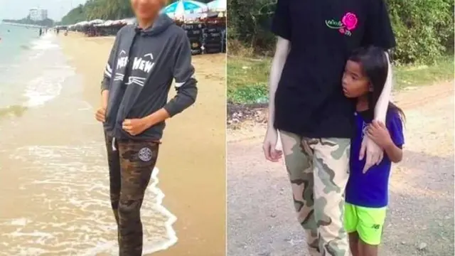 Viral Krim Pemutih yang Hasilnya Bikin Warganet Bergidik