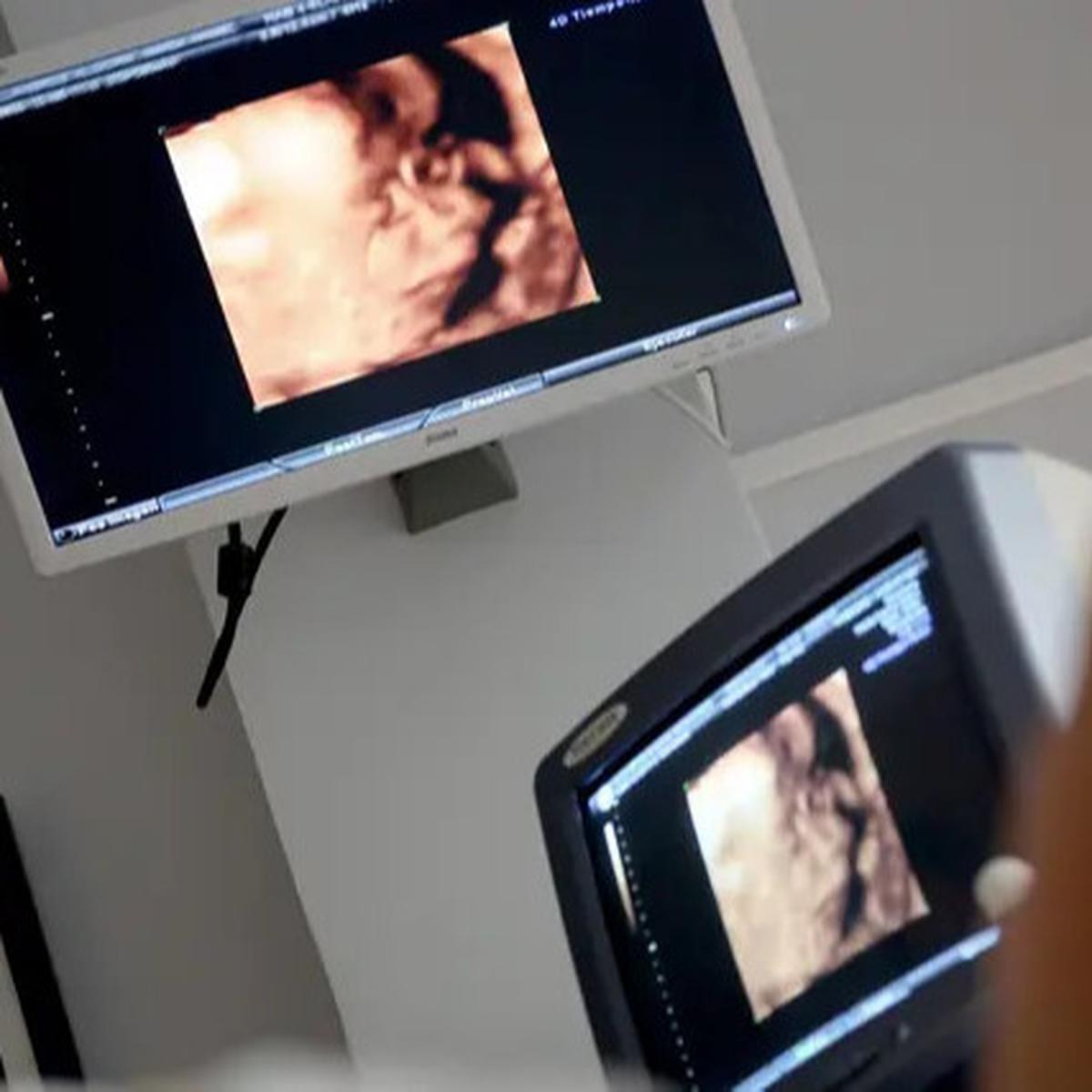 Kepala Bayinya Tak Terlihat saat Periksa USG, Kisah Calon Ibu Ini Bikin Haru