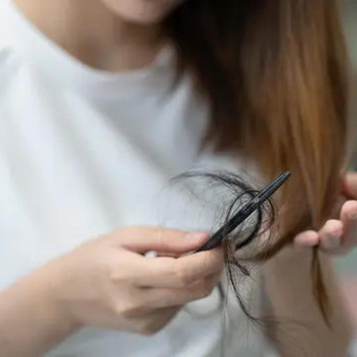 5 Cara Mengatasi Rambut Rontok Secara Alami, Bisa Dicoba di Rumah