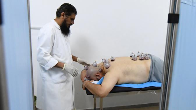 Spesialis melakukan pengobatan hijama atau terapi bekam basah kepada pasien di sebuah klinik di Ajman, Uni Emirat Arab, Kamis (15/8/2019). Hijama adalah teknik pengobatan dengan jalan membuang darah kotor (racun yang berbahaya) dari dalam tubuh melalui permukaan kulit. (KARIM SAHIB/AFP)