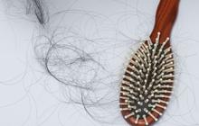 Rambut Rontok Ternyata Tak Cukup Diatasi Pakai Sampo Saja, Solusinya?