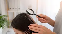 How To Get Rid Of Dandruff Fast: 12 Expert Tips for a Flake-Free Scalp