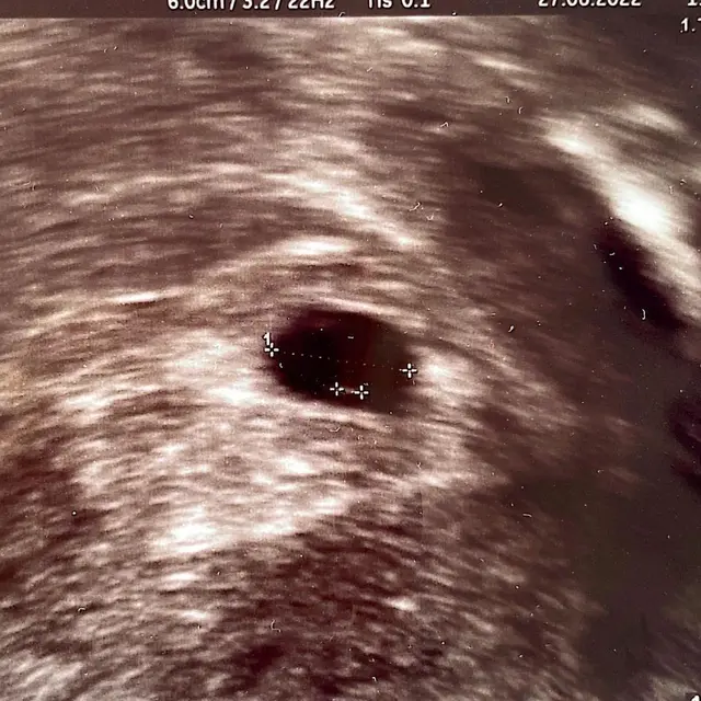 [Fimela] Annisa Pohan dan Agus Harimurti Yudhoyono