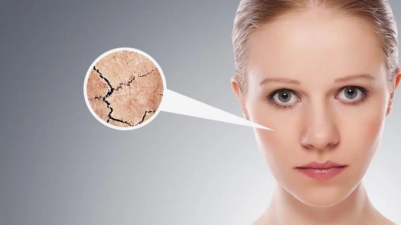 7 Penyebab Kulit Kering yang Perlu Diwaspadai, Ketahui Cara Mengatasinya
