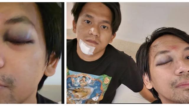 Rian d masiv kecelakaan mobil