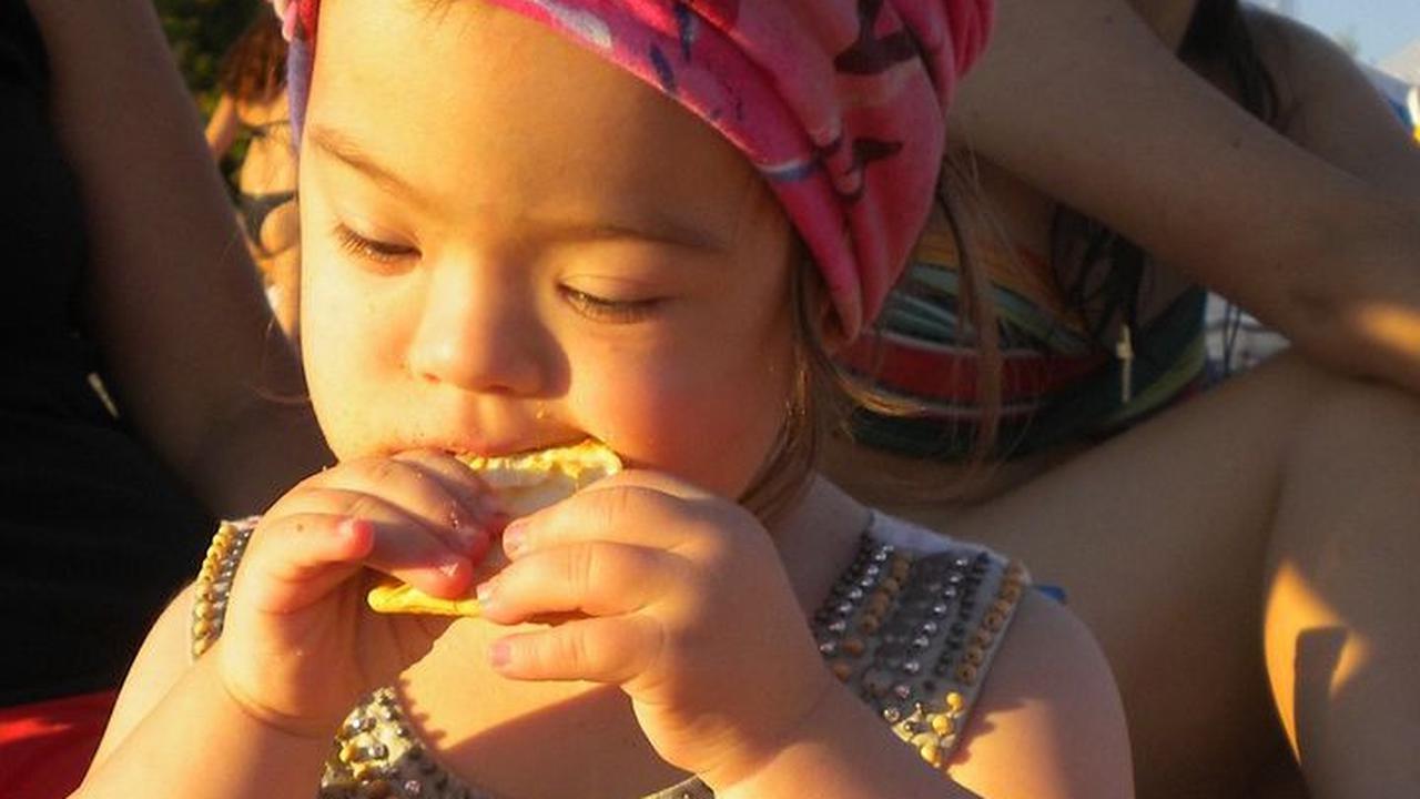Cara Merawat Anak Down Syndrome
