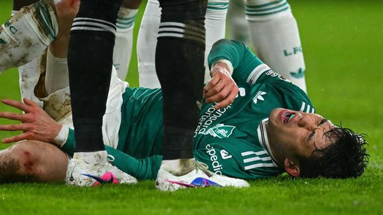 Liverpool Dapat Kabar Baik, Wataru Endo Berpeluang Kembali di Fase Akhir Musim