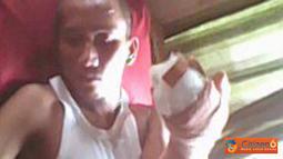 Diduga karena salah paham, Ahmad Jailani (Mamad), warga Sumberwaru, Kecamatan Banyu Putih, menjadi korban pembacokan orang tak dikenal, Kamis (24/3). (Pengirim: Mamad)