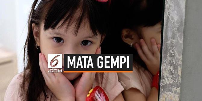 VIDEO: Masih 4 Tahun, Mata Gempi Minus dan Silinder