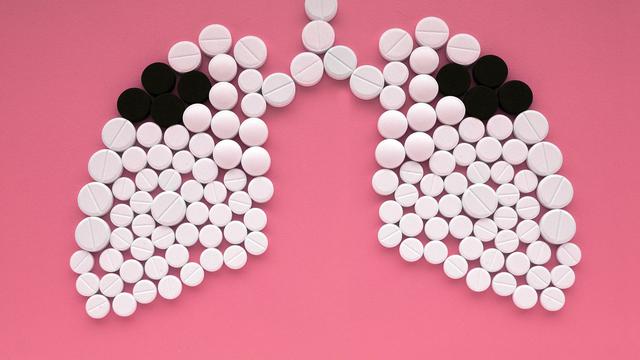 Ilustrasi TB - TBC (iStockphoto)