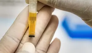 7 Warna Urine dan Artinya yang Perlu Anda Tahu