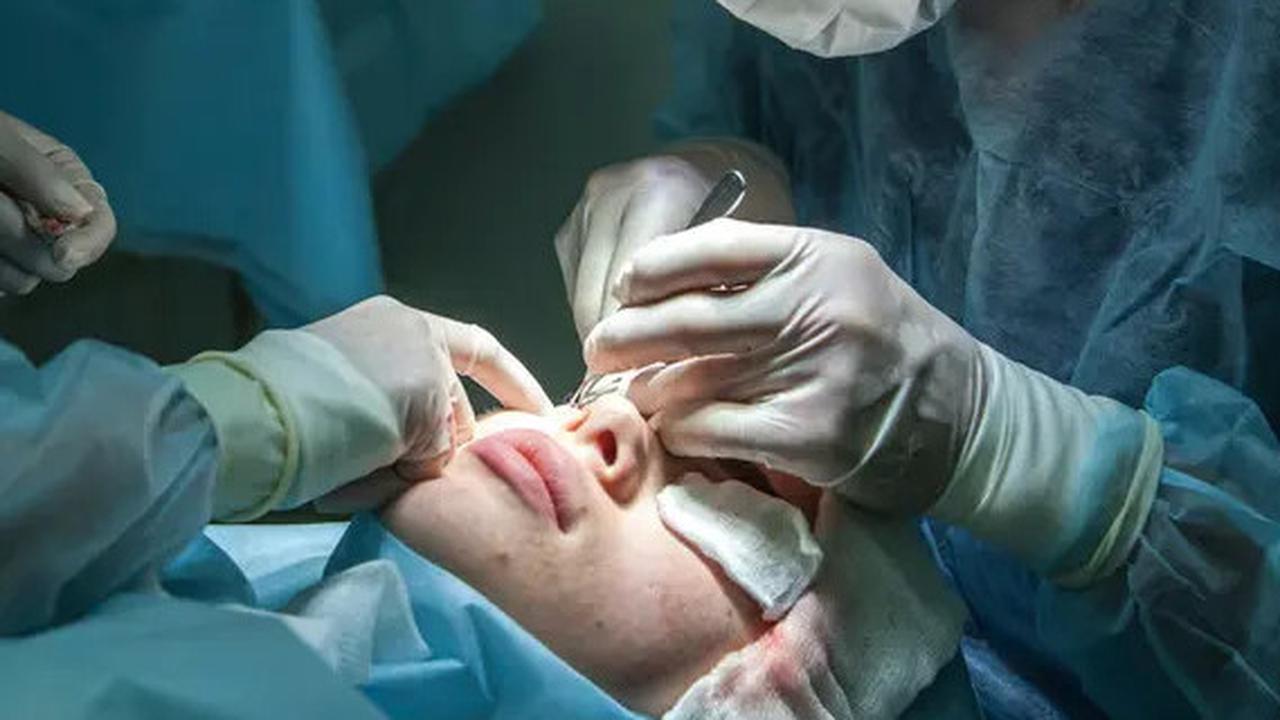 Operasi Plastik: Transformasi Kecantikan, Risiko, dan Efek Samping yang Perlu Diperhatikan