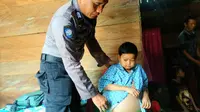 Kondisi Adi Ardiansyah (16) remaja asal Kabupaten Konawe yang wajahnya masih seperti bocah berusia 8 tahun setelah terjatuh dari pohon, delapan tahun silam. (Liputan6.com/Ahmad Akbar Fua)