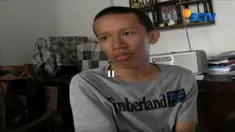 Perundungan terhadap mahasiswa Universitas Gunadarma berkebutuhan khusus viral di media sosial. 