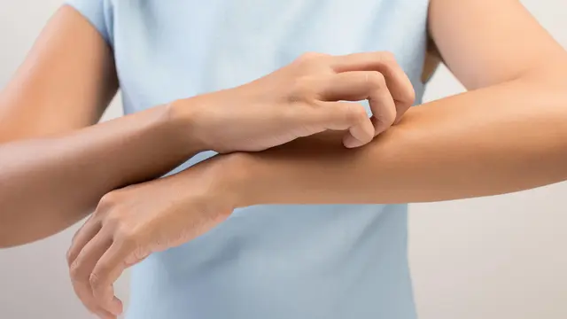 7  Arti Tanda Bintik Merah pada Tubuhmu