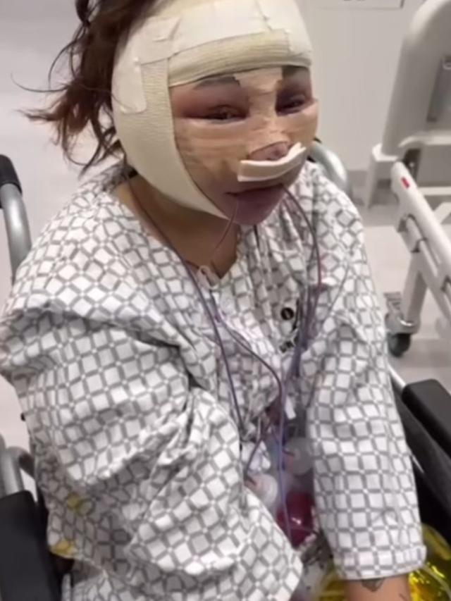 King Abdi ungkap perjalanan istri jalani oplas di Korea. (credit:instagram.com/kingabdi_jajanmercon/newvelle.solutions/indriani.dina)