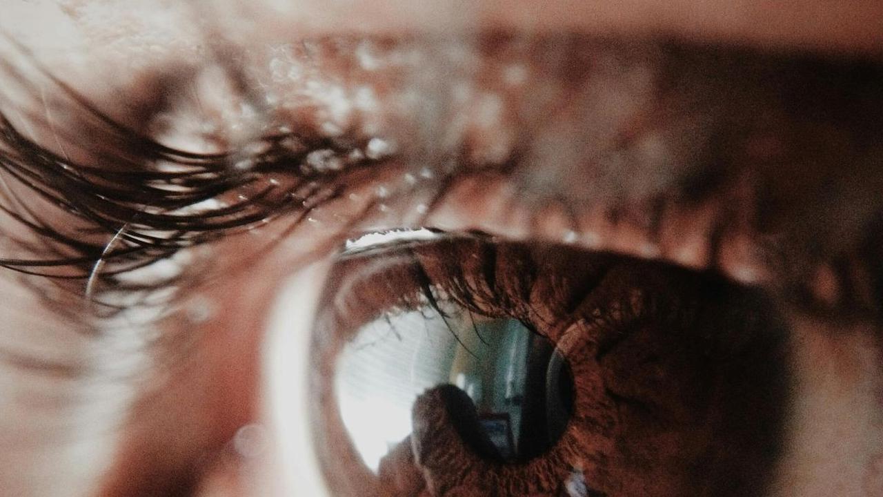 Beberapa bahkan mengalami mata hitam super gelap, menandakan beban yang terlalu besar pada bagian wajah mereka.