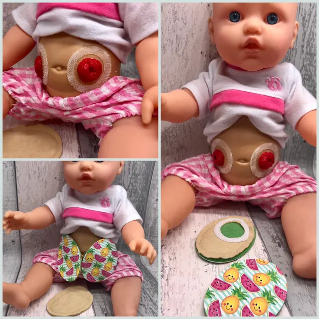 Ibu Ini Desain Boneka Inklusif untuk Anak Disabilitas, Hasilnya Menakjubkan