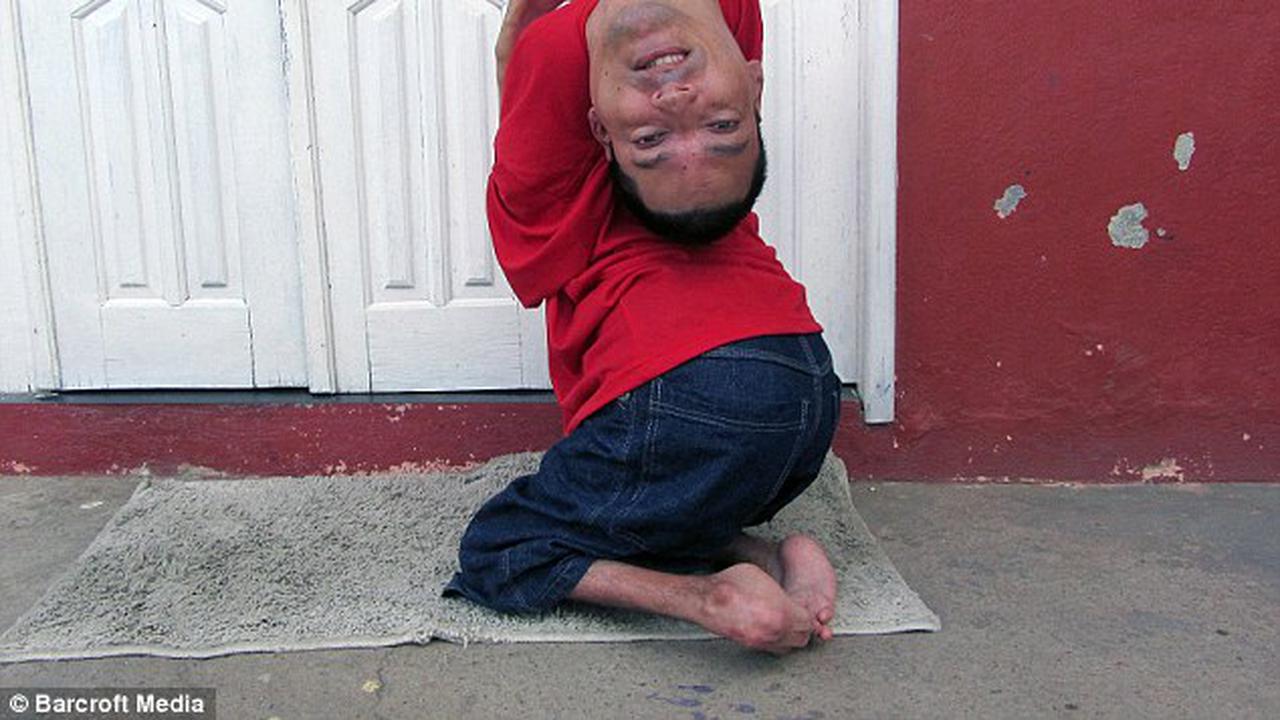 Berkepala Terbalik, Pria Ini Sukses jadi Akuntan