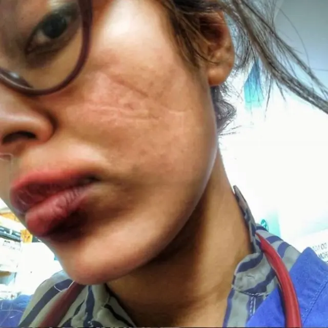 Unggah Kondisi Wajah Rusak Karena Masker, Miss England 2019 Beri Pesan Menohok