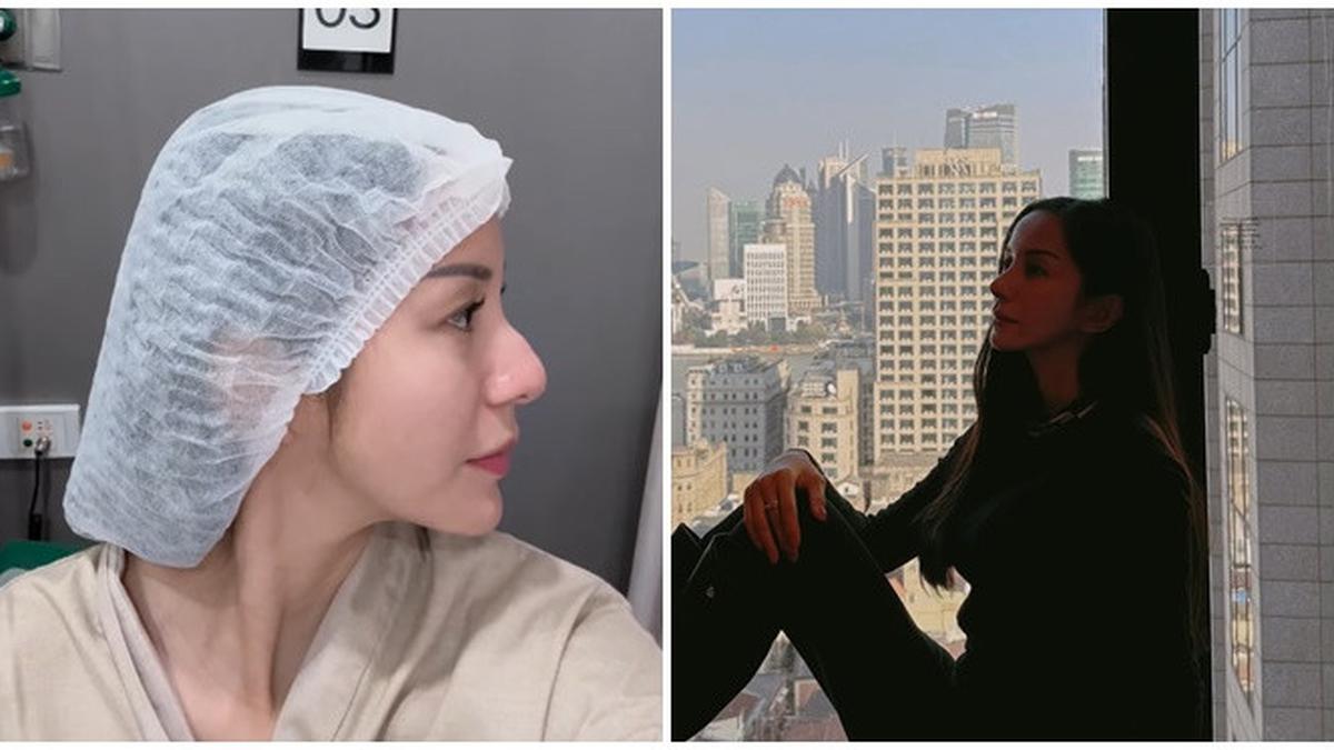 Hidungnya Bengkok, Ini 6 Potret Terbaru Kirana Larasati Usai Rhinoplasty di Thailand
