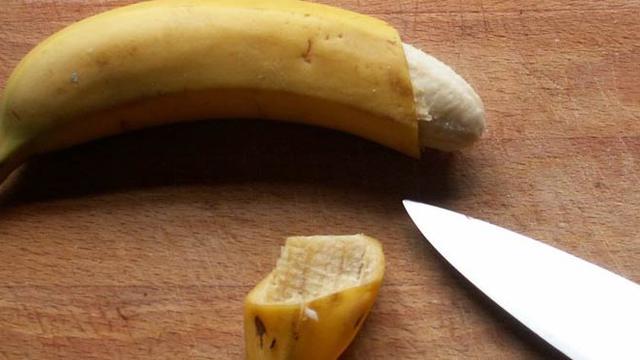 7 Manfaat Sunat Bagi Kesehatan Pria Health Liputan6 Com