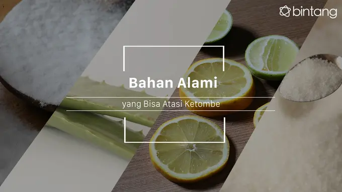 Atasi Ketombe dengan 5 Cara Ini, Dijamin Hilang!