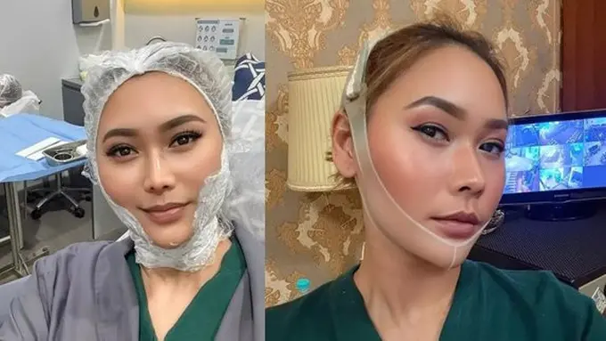 Rahasia Wajah Tirus dan Awet Muda Ala Inul Daratista. (instagram/inul.d)