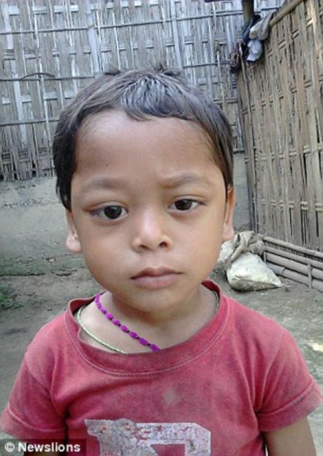 Sagar Dorji sebelum ia mengalami kondisi langka | Photo: Copyright asiantown.net